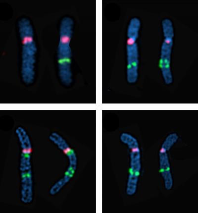 Autism Linked to Increased Genetic Change in Regions of Genome Instability