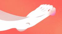 Foot with Gout