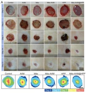 Fig. 4 The Mito-AVM@HPP system promotes healing of diabetic wounds.