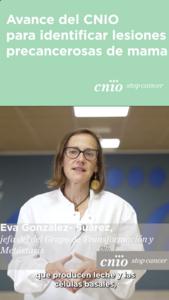 A CNIO group contributes to identifying which breast lesions will progress to cancer, thus helping avoid overtreatment