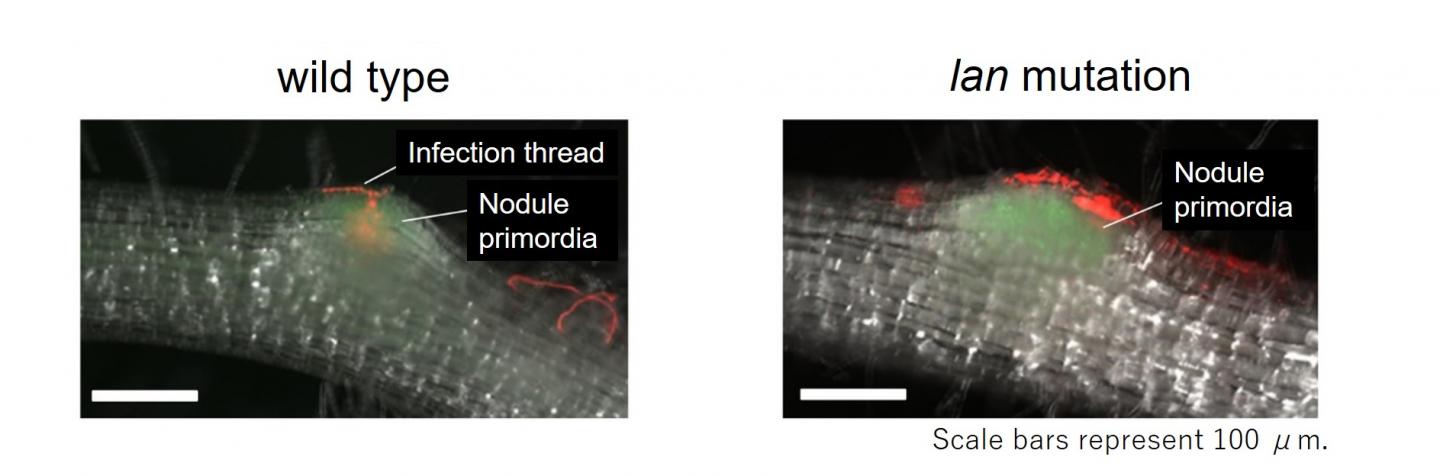 Living Together: How Legume Roots Accommodate Two Distinct Microbial Partners