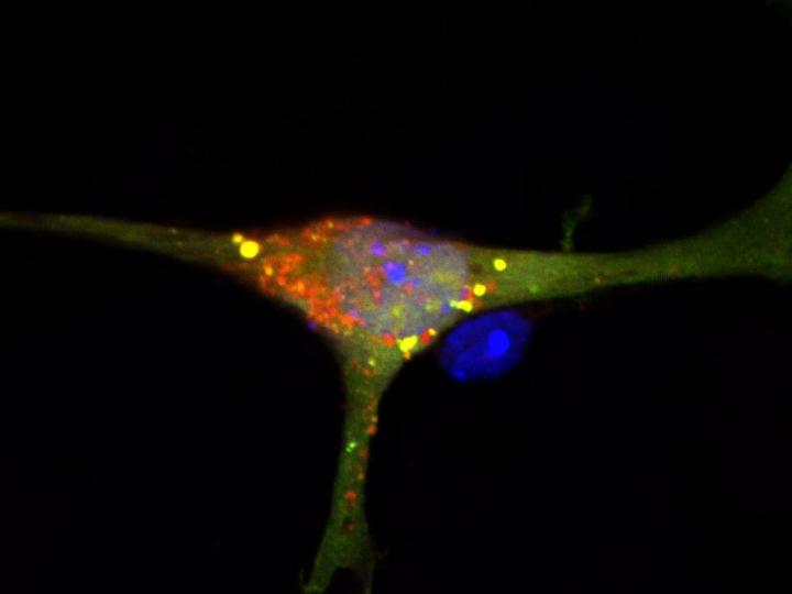 Nerve Cells with Disrupted S1P Breakdown