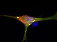 Nerve Cells with Disrupted S1P Breakdown
