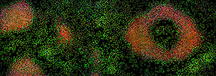 Stem Cells
