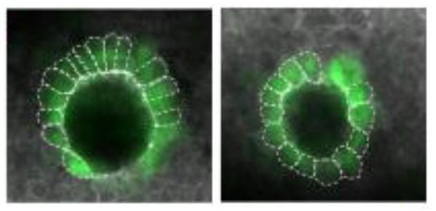 Maternal Genes Shape Development