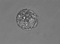 In vitro Fertilization