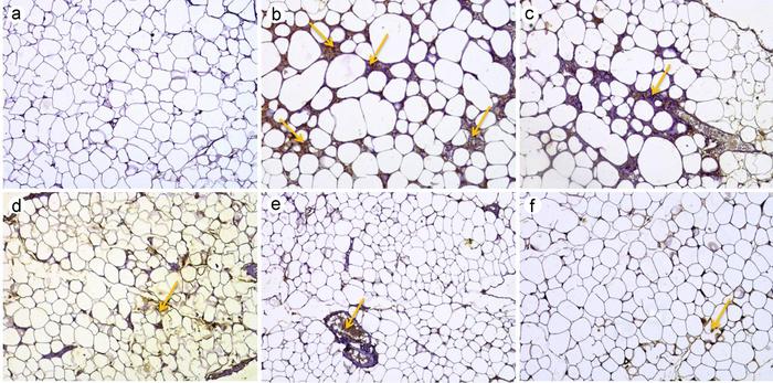 Effect of MD-1 on TNF-α infiltration in epididymal fat pads
