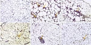 Effect of MD-1 on TNF-α infiltration in epididymal fat pads