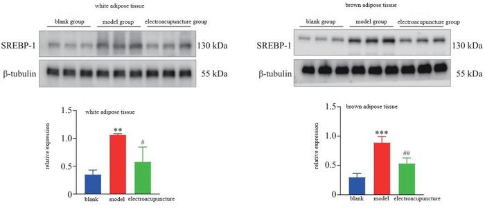 Comparison of SREBP-1 protein expression of rats in the 3 groups (x̅±s，3 rats/group ).