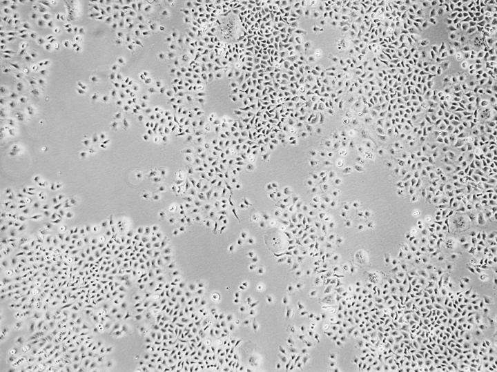 Cells vs. Virus