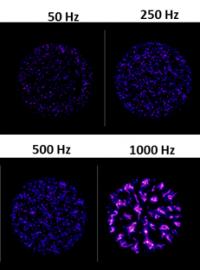 The Fourth State of Matter, Plasma: a Technology to Improve Bone Healing?