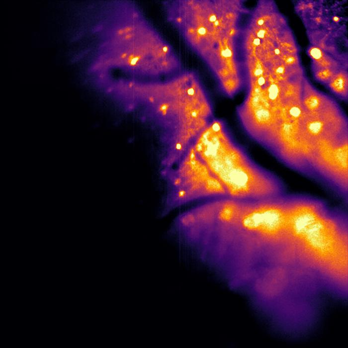 Brain imaging gets a glow-up