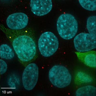 A Team of Scientists Led by Salk and Yale Discover a Small Protein Important for Cellular Housekeepi