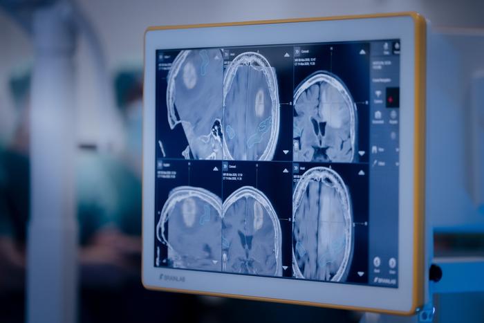 Medical imaging supports the planning of modern radiation therapy, with federated AI approaches possibly opening up new prospects. (Photo: Magali Hauser, KIT)