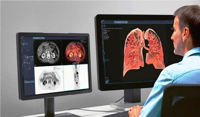 Automatic medical image segmentation models are becoming powerful diagnostic tools