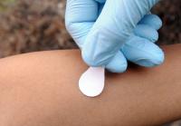 Applying Microneedle Patches