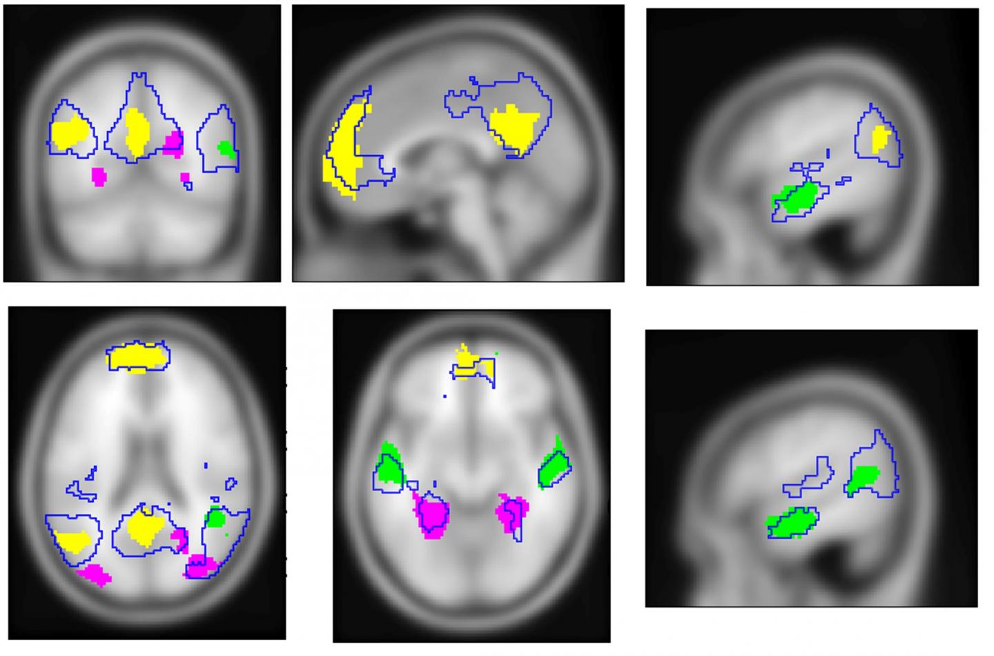 Cognitive Systems