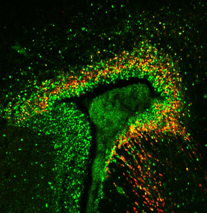 Salk Scientists Uncover Pathway