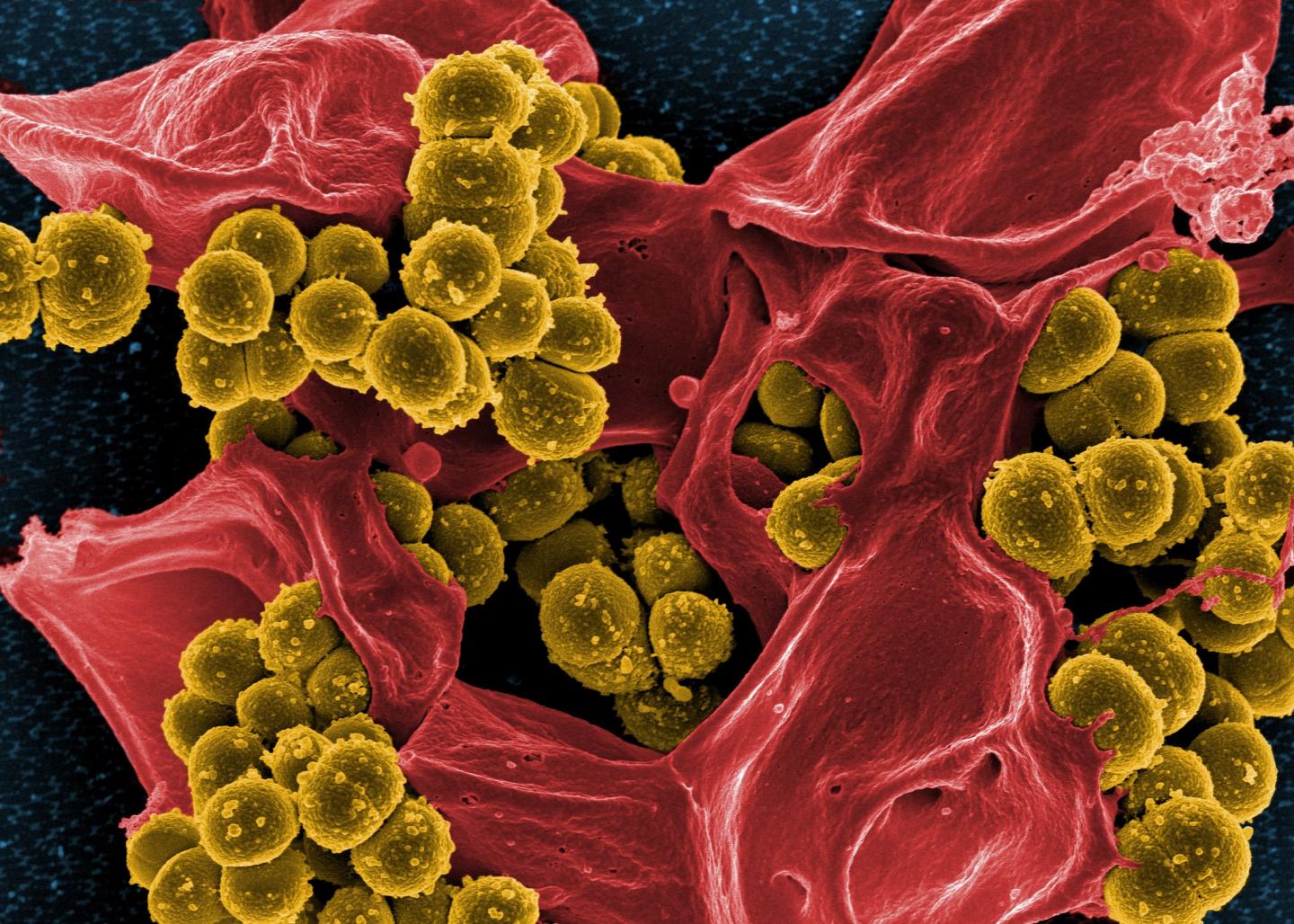 Methicillin-resistant Staphylococcus aureus Bacteria