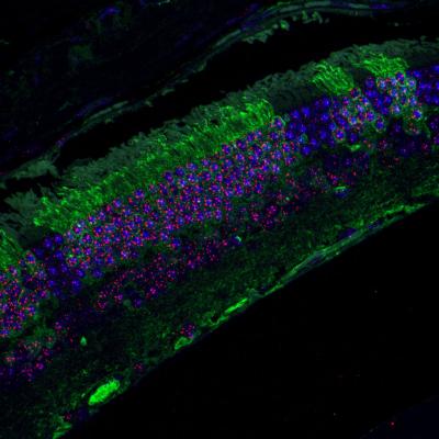 Eye of Chimeric Mice