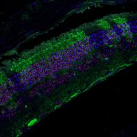 Eye of Chimeric Mice