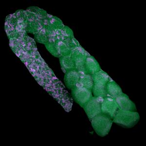 Ostracod ovarium with endosymbiotic bacteria