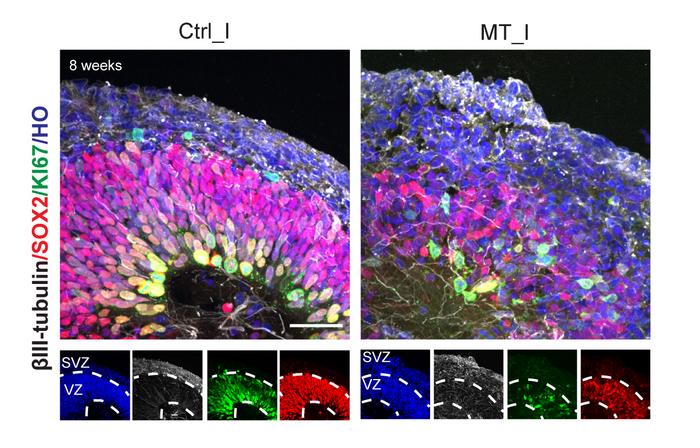 Brain organoids