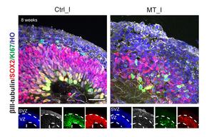 Brain organoids