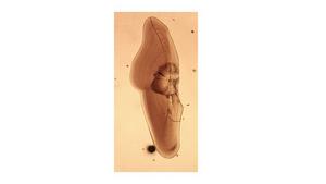 Growth rings
