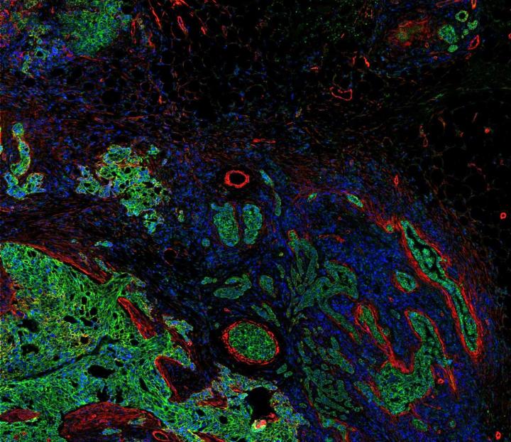 View of Tumor's Cellular Landscape and Surrounding Tissue
