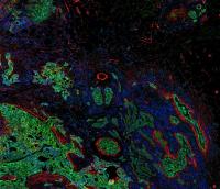 View of Tumor's Cellular Landscape and Surrounding Tissue