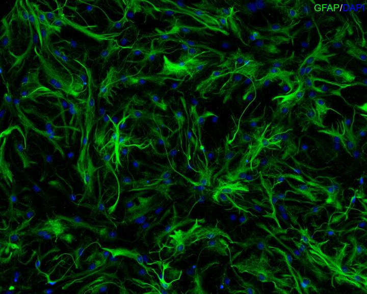 Astrocytes