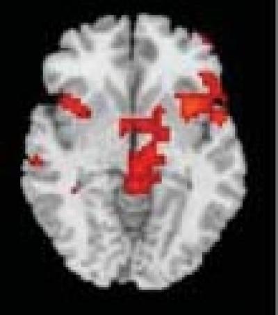 Anterior Cingulate Cortex
