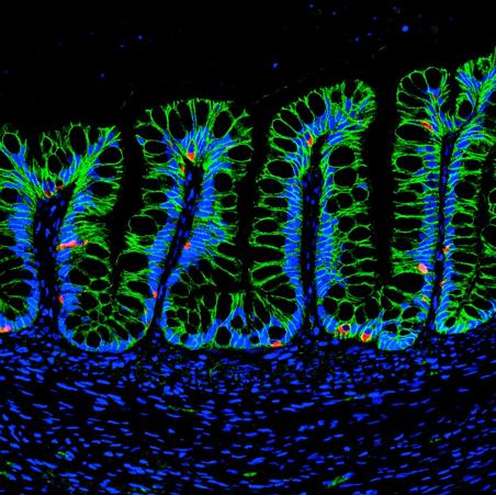 Differentiating Human Intestinal Organoids