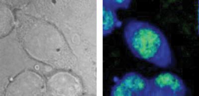 Faster CARS, Less Damage: NIST Chemical Microscopy Shows Potential for Cell Diagnostics