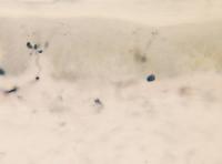 Small Nerve Fibers
