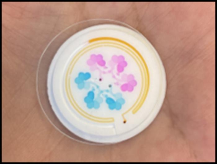 Skin-interfaced microfluidic sensor for point-of-care medical devices