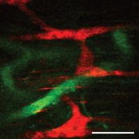 Enteric Photo