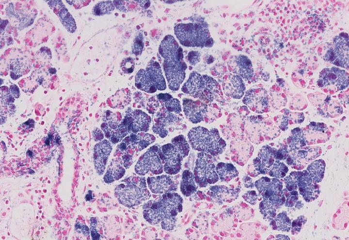 Progenitor Cells