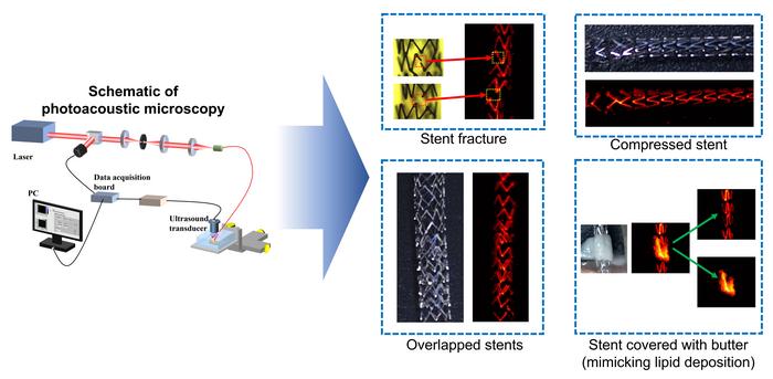 Instrument schematic and stent images