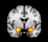 Amygdala