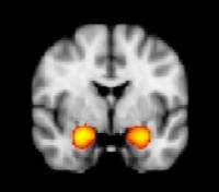 Amygdala