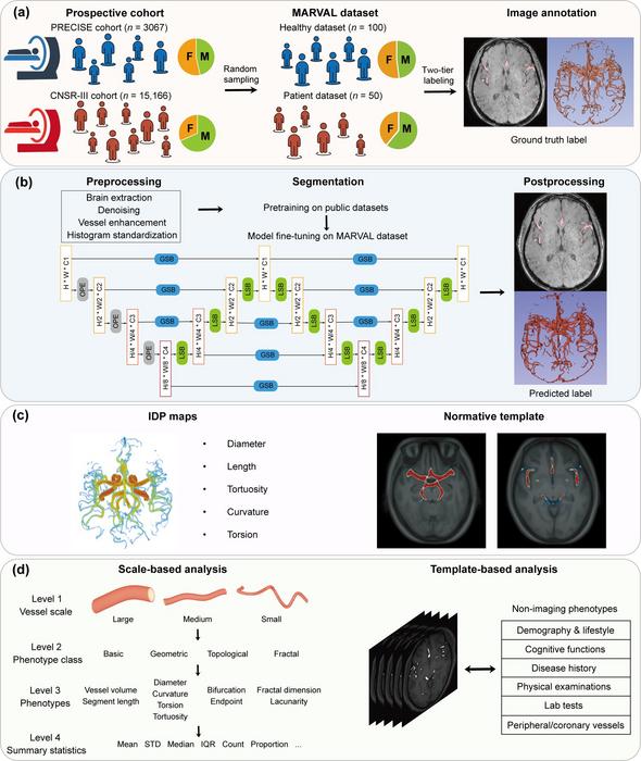 New brain-vessel atlas maps vascular aging and points to stroke recovery risks