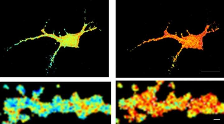Measure of the Activity of the CaMKII Enzyme