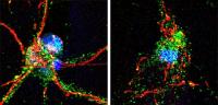 Mouse Neurons with Intact and Damaged Axons