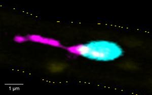A single platelet forming pro-inflammatory PITTs in an inflamed blood vessel.