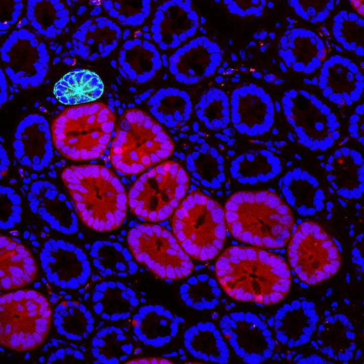 Red2Onco confocal microscopy 3