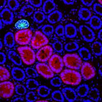 Red2Onco confocal microscopy 3