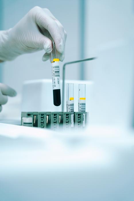 Blood test trends may help identify patients at increased risk of cancer
