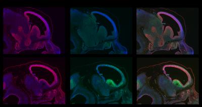 BRCA1 and Brain Development